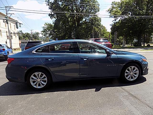  2025 Chevrolet Malibu Image: 5